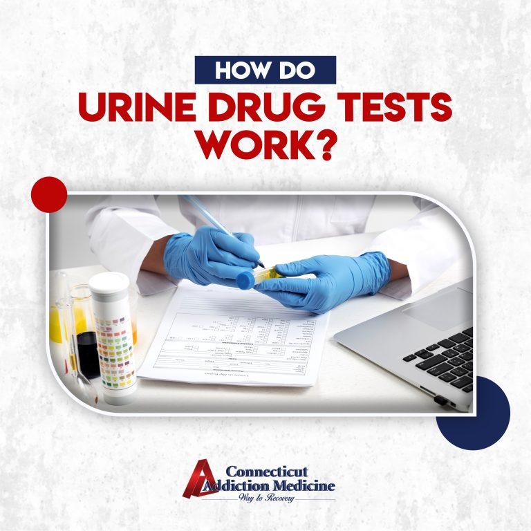 How Do Urine Drug Tests Work? 5 Powerful Facts