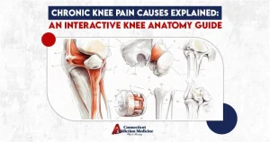Chronic Knee Pain Causes Explained An Interactive Knee Anatomy Guide